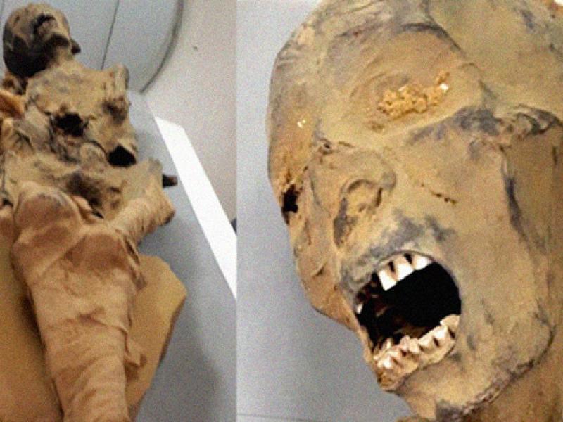 Եգիպտացի գիտնականները բացահայտել են «ճչացող կնոջ» մումիայի գաղտնիքը